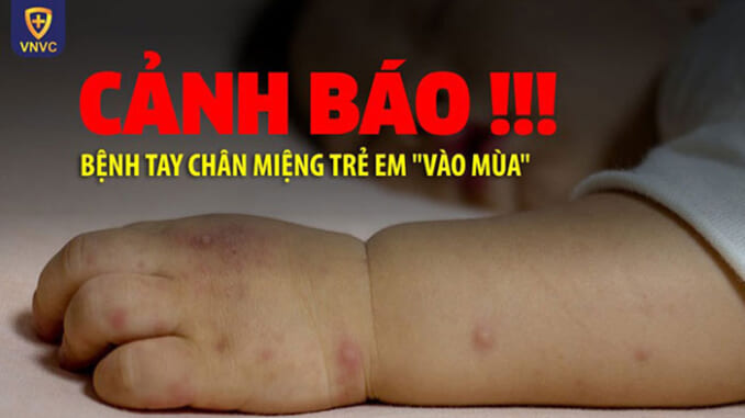 'Điểm mặt' 7 căn bệnh mùa hè nguy hiểm trẻ thường hay mắc phải 'Điểm mặt' 7 căn bệnh mùa hè nguy hiểm trẻ thường hay mắc phải