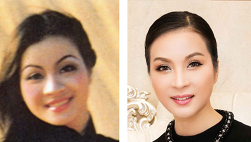 MC Thanh Mai, BB Thanh Mai, Trẻ hóa da, Mặt Vline, Thanh Mai