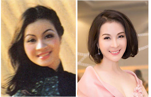 Ca sĩ Ngọc Anh, MC Thanh Mai, Phi Nhung, Trẻ hóa da, BB Thanh Mai