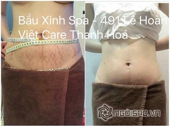 Bầu Xinh - Việt Care, spa, làm đẹp, chăm sóc da, massage Bầu & Chăm sóc sau sinh, Bầu Xinh Spa