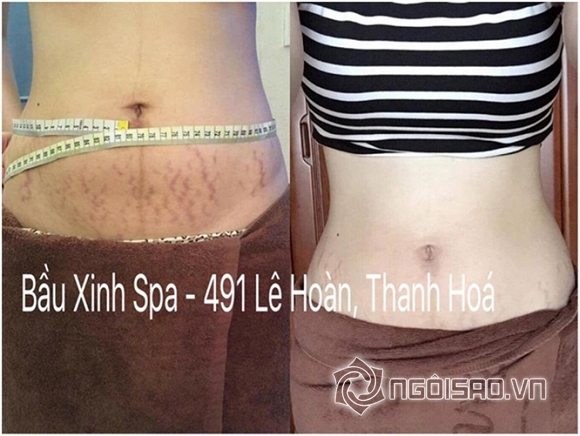 Bầu Xinh - Việt Care, spa, làm đẹp, chăm sóc da, massage Bầu & Chăm sóc sau sinh, Bầu Xinh Spa