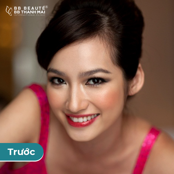 BB Thanh Mai, Trẻ hóa da, MC Thanh Mai