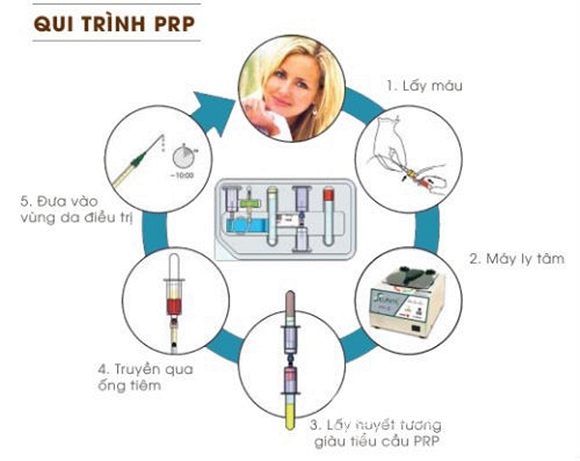 Thẩm mỹ Phương, công nghệ PRP, PRP, Platelet Rich Plasma, Huyết tương giàu tiểu cầu, Mỹ viện Phương