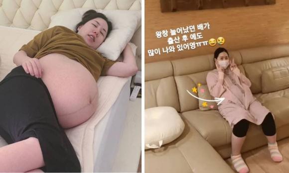 2 tháng sau khi sinh ba, thân hình của mỹ nhân Hàn từng nặng hơn 100kg như thế nào mà gây choáng đến vậy?