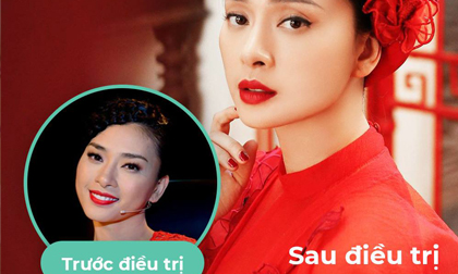 Siêu mẫu Thúy Hạnh, BB Thanh Mai, Trẻ hóa da