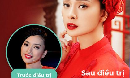 MC Đại Nghĩa, BB Thanh Mai, trẻ hóa da