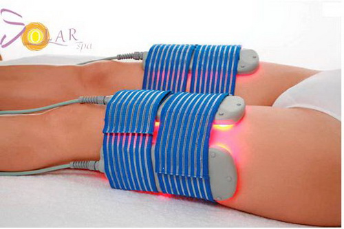 Solar spa, Giảm béo, Công nghệ giảm béo, Giảm béo bằng phương pháp Lipo Laser 3D