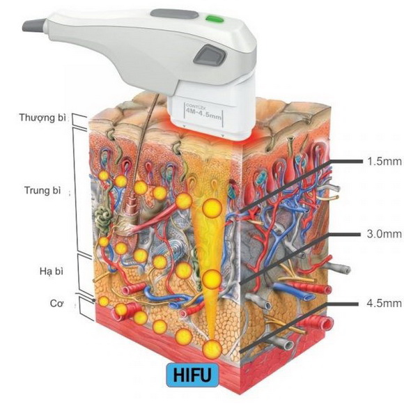 Trẻ hóa da, Làm đẹp không dao kéo, TaTa International Clinic