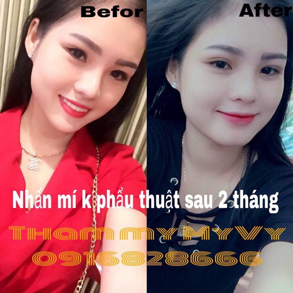 Thẩm mỹ MyVy , Phun xăm thẩm mỹ, Phun mày, Phun môi