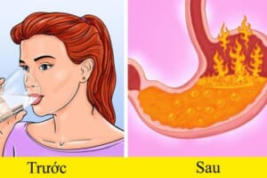 Nó là ‘sát thủ sức khỏe’ trong mùa đông, người trung niên và cao tuổi nên đề phòng nhất! Hướng dẫn bạn 3 cách phòng tránh dễ dàng